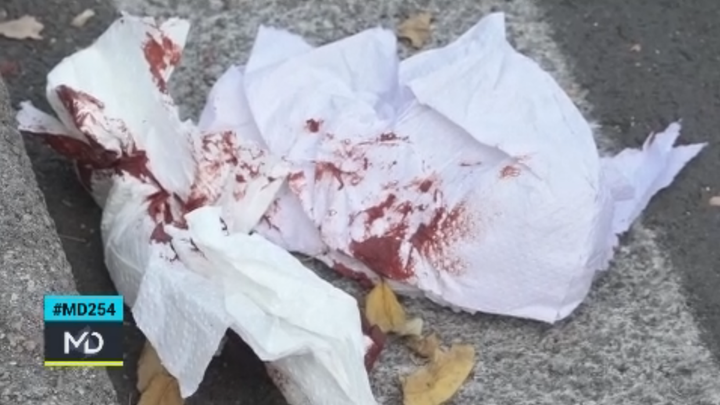 Restos de la agresión a un taxista