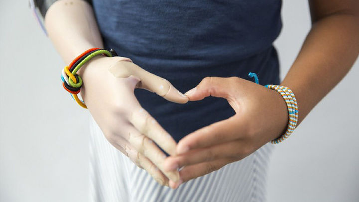 La llegada de la impresión 3D ha supuesto la mejora en el sector médico / ARCHIVO