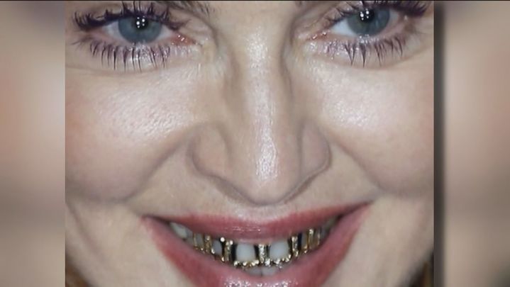 Piercing dental de Madonna / REDACCIÓN