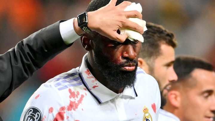 Antonio Rudiger / EFE