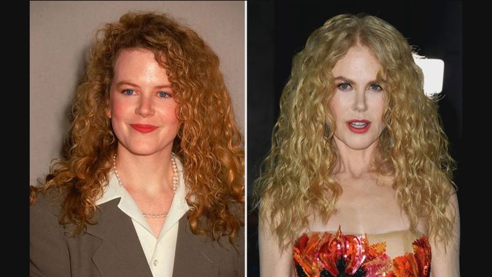 Nicole kidman, sus retoques estéticos / TELEMADRID