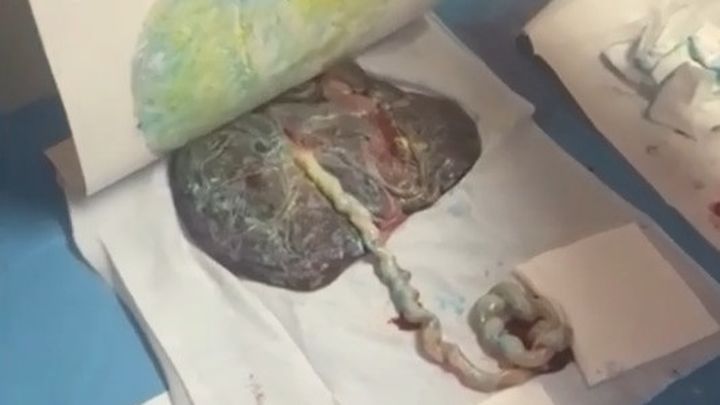 Placenta artificial / EUROPA PRESS