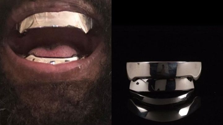 Dentadura de titanio de Kanye West / Telemadrid