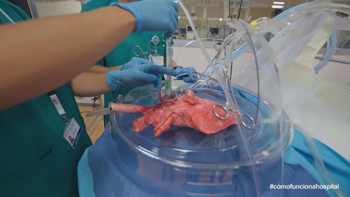 Ex-vivo / TELEMADRID