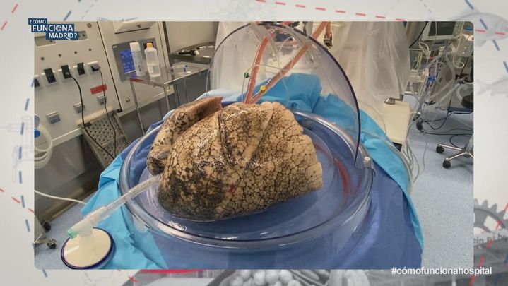 Cómo funciona Madrid_ Cap_ 10 ¿Cómo funciona el Hospital Puerta de Hierro__59730 / TELEMADRID