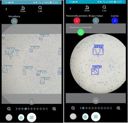 Algoritmo de detección y clasificación de microfilarias / SPOTLAB