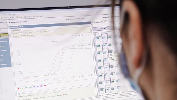 Pantalla de un ordenador con resultados positivos de viruela del mono / Europa Press