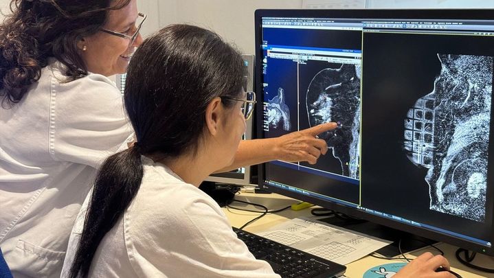 Se calcula que en el año 2030 se diagnosticarán 626 casos nuevos por cada cien mil habitantes / EUROPA PRESS